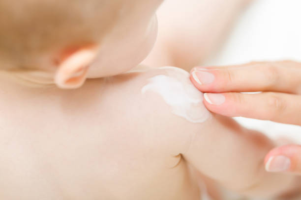 Atopijski dermatitis 4 istockphoto 1253473636 612x612 1