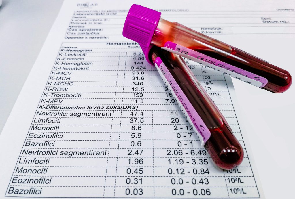Iskanje vzrokov - kaj testiramo v funkcionalni medicini? 2 4f61403b adf3 401c 8416 c377acb6eb18