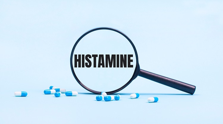 Histaminska intoleranca 1 v654bf8810d87d upgates cannatura histamin intolerance cz